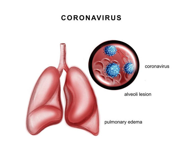 コロナウイルスの病原体のイラスト  - 写真・画像
