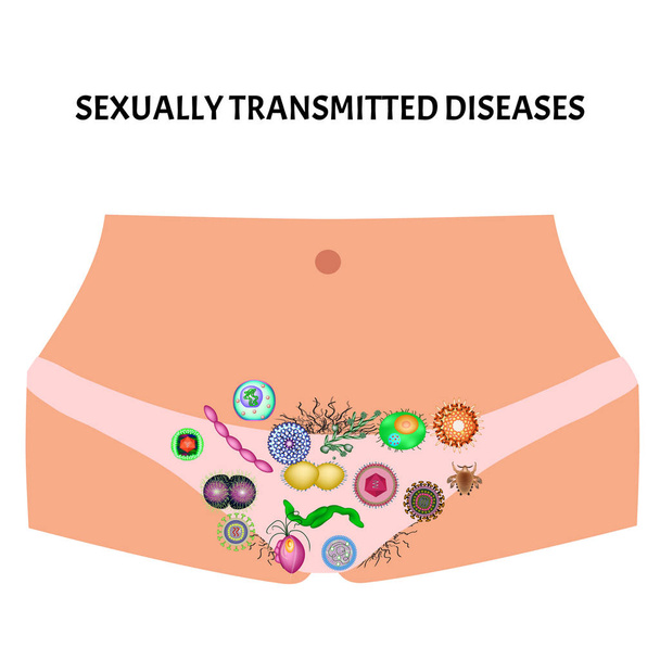 Viral and bacterial infections. Sexually transmitted diseases. Infographics. Vector illustration on isolated background. - Vector, Image