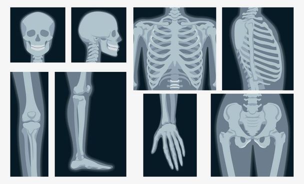 Різні рентгенівські знімки набору частин тіла людини Векторні плоскі ілюстрації
 - Вектор, зображення