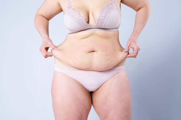 Tummy tuck, flabby skin on a fat belly, plastic surgery concept - Foto, Bild