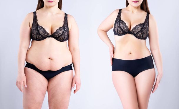 Woman's body before and after weight loss on gray background - Photo, Image