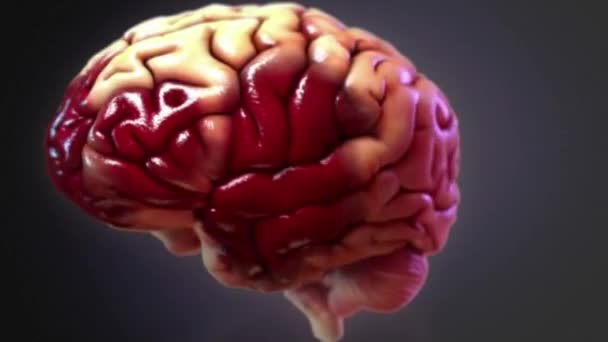 Traumatické poranění mozku, známé také jako intrakraniální poranění, nastává, když vnější síla poraní mozek - Záběry, video