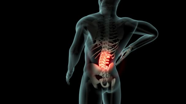 Dieses Video zeigt Rückenschmerzen - Filmmaterial, Video