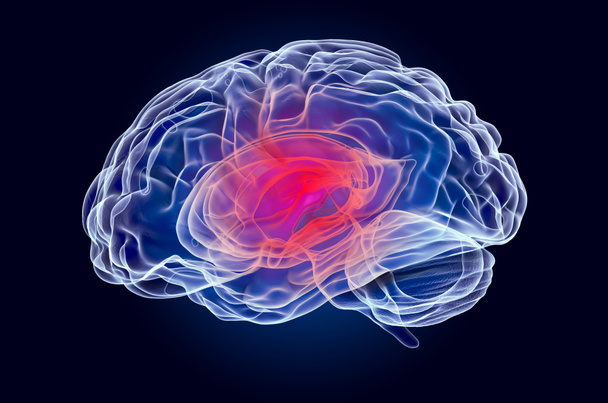 Koncepcja choroby mózgu, hologram rentgenowski. 3d renderowanie - Zdjęcie, obraz