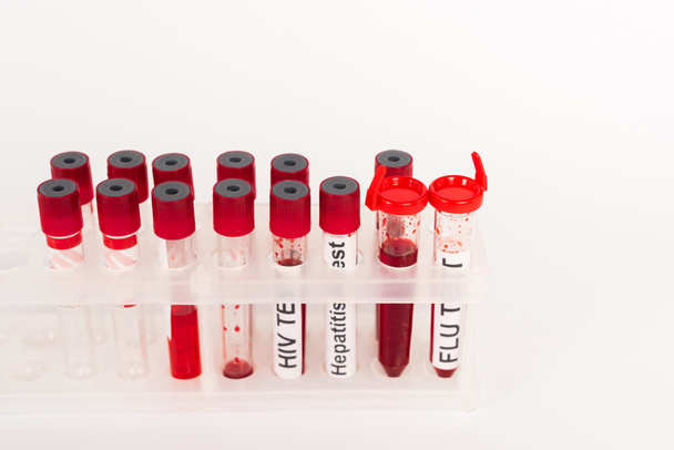 Kan örnekleri ve beyaz harflerle izole edilmiş test tüpleri.  - Fotoğraf, Görsel
