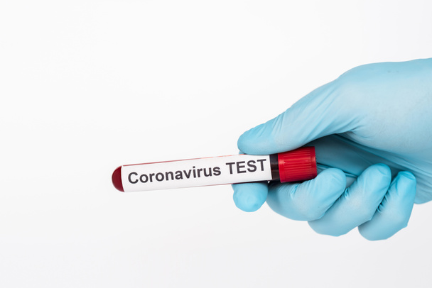 cropped view of scientist holding sample with coronavirus test lettering isolated on white  - Fotografie, Obrázek