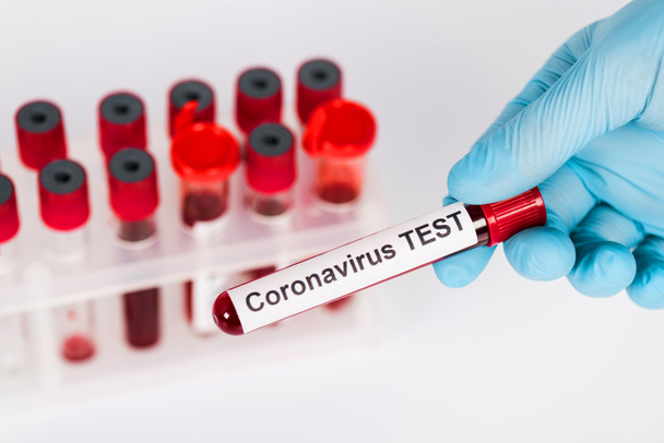 selective focus of scientist holding sample with coronavirus test lettering near test tubes isolated on white  - Foto, Imagem