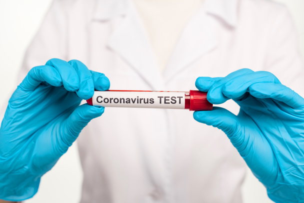 cropped view of scientist in latex gloves holding sample with blood and coronavirus test lettering isolated on white  - Photo, Image