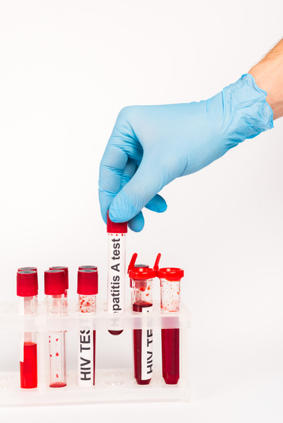 vista recortada del científico en guante de látex azul que sostiene la muestra con hepatitis una letra de prueba aislada en blanco
  - Foto, Imagen
