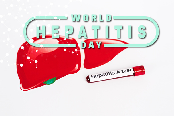 minta hepatitis egy teszt közel a világ hepatitisz nap betűkkel és a lehúzott máj fehér  - Fotó, kép