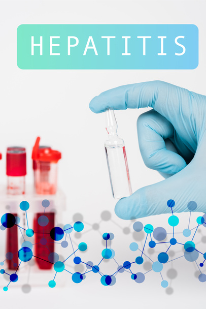 Bilim adamının cam şişeyle test tüplerinin yanında sıvı ve beyaz üzerinde hepatit harfleri olan görüntüsü.  - Fotoğraf, Görsel
