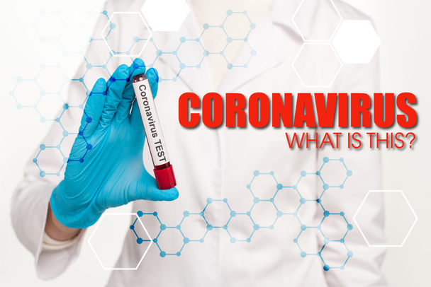 καλλιεργημένη άποψη του επιστήμονα κρατώντας δείγμα με αίμα και coronavirus δοκιμή κοντά coronavirus τι είναι αυτό το γράψιμο σε λευκό  - Φωτογραφία, εικόνα
