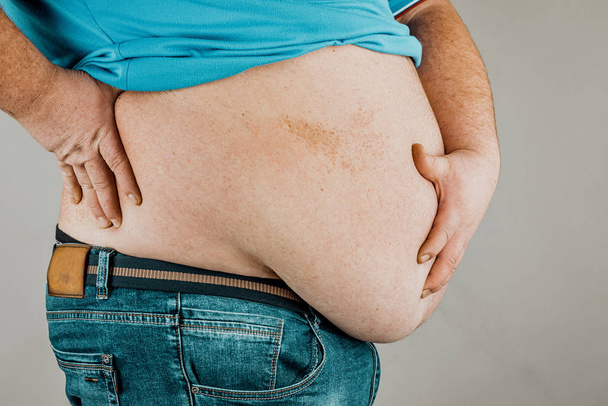 Overweight of a person's body with hands touching the abdomen. T - Photo, Image