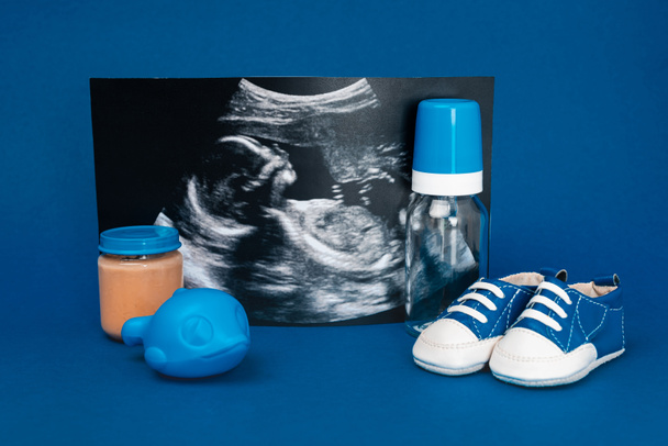 ultrasound scan, baby bottle, toy, baby shoes, jar with baby food ob blue background  - Photo, Image