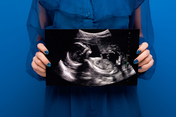 обрізаний вид жінки, що тримає ультразвукове сканування ізольовано на синьому
  - Фото, зображення