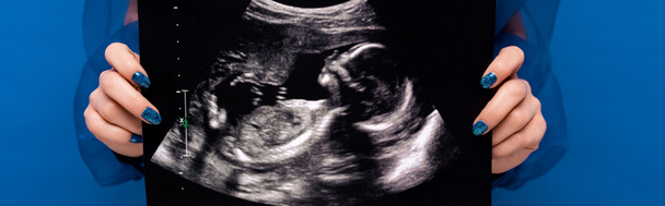 panoramatický snímek ženy držící ultrazvuk izolovaný na modré  - Fotografie, Obrázek
