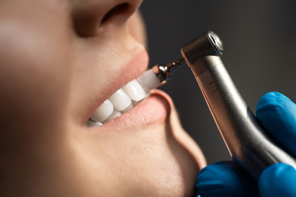 διαδικασία χρήσης οδοντιατρικής βούρτσας ως στάδιο επαγγελματικής διαδικασίας οδοντιατρικού καθαρισμού σε στενή κλινική, έννοια υγειονομικής περίθαλψης - Φωτογραφία, εικόνα