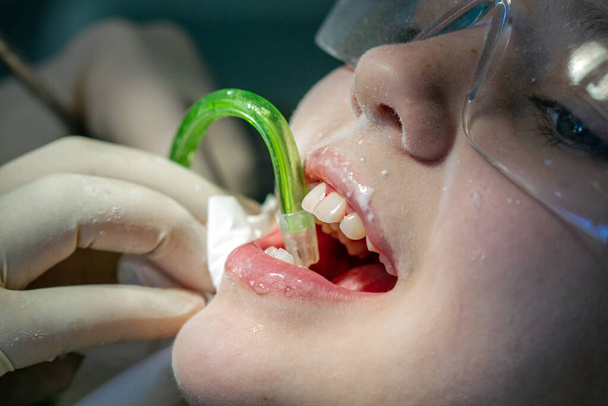 Дівчинка за призначенням стоматолога. Огляд ротової порожнини і зубів у дитини
. - Фото, зображення