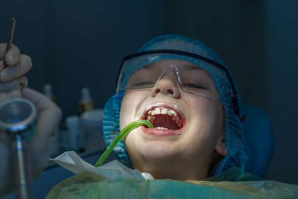 Dişçi randevusundaki kız. Bir çocuktaki ağız boşluğu ve dişler inceleniyor.. - Fotoğraf, Görsel