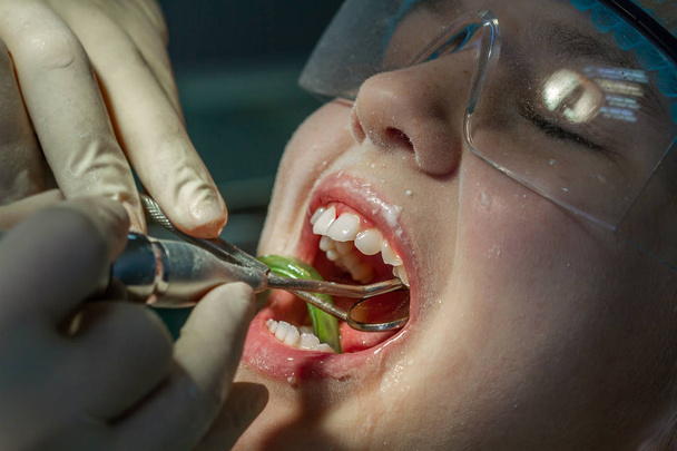 Girl at the dentist's appointment. Inspection of the oral cavity and teeth in a child. - Photo, Image