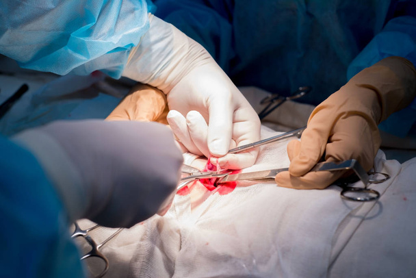 χειρουργικά ράμματα. Τα χέρια του χειρουργού και του βοηθού σε ένα αποστειρωμένο χειρουργείο επιβάλλουν ένα καλλυντικό ράμμα στο δέρμα του παιδιού του ασθενούς. - Φωτογραφία, εικόνα