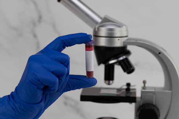 Nurse holding test tube with blood, close-up. Blood test concept - Photo, Image