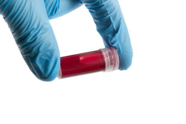 esame del sangue tubo in mano medico
, - Foto, immagini