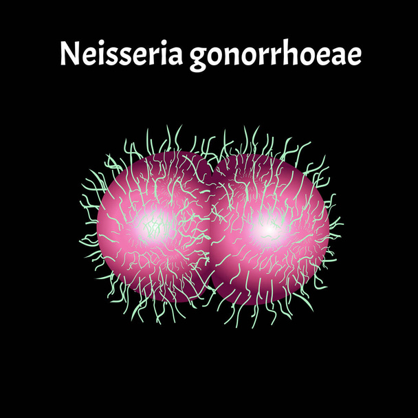Gonococcus struktúra. Neisseria gonorrhoeák. Gonorrhea betegség. Venereális betegség. Infografikák. Vektorillusztráció. - Vektor, kép