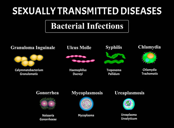 Sifilide, spirochete, Treponema, Gonococco, Gonorrea, clamidiosi, clamidia, micoplasma, infezione batterica da ureaplasma. Malattie a trasmissione sessuale. Infografica. Illustrazione vettoriale
 - Vettoriali, immagini