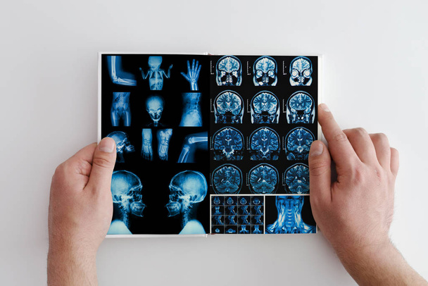 手は頭、首、患者の脳のMRIスキャンを保持し、手をつないで保持します。頭痛のような病気の原因を決定する神経系の器官の器官解剖学の概念写真 - 写真・画像