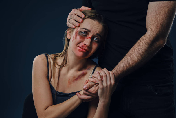 Man put his hand on female head, like hugging. They holding hands. Victim with bruises sitting nearby. Blue background. Domestic violence. Close-up. - Photo, Image