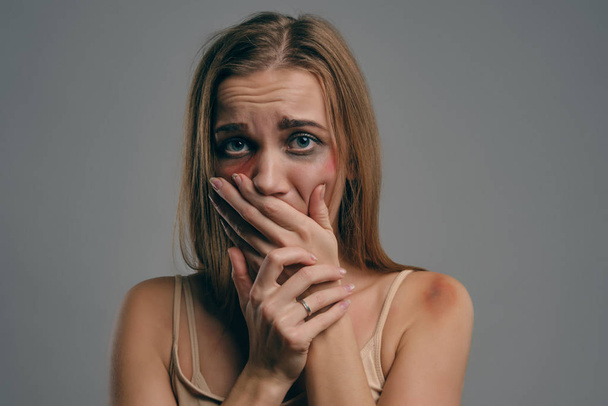 Blonde girl with bruises is covering her face, posing on gray studio background. Domestic violence, abuse. Close-up, copy space. - Photo, Image