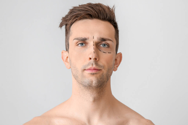 Young man with marks on his face against light background. Concept of plastic surgery - Photo, Image