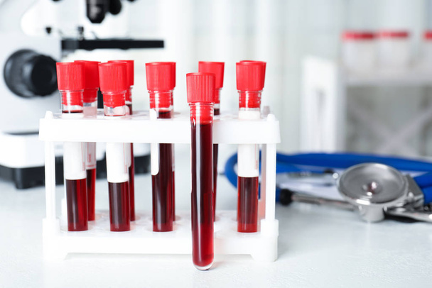 Test tubes with blood samples on table in laboratory. Virus research - Φωτογραφία, εικόνα