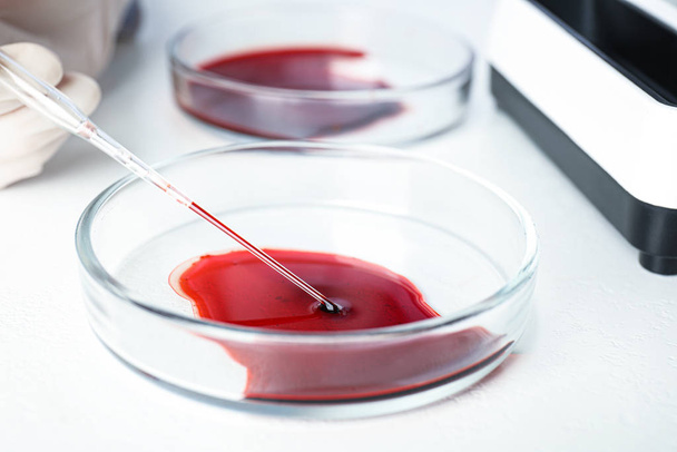 Bilim adamı laboratuarda pipetle Petri kabından kan örneği alıyor, yakın plan. Virüs araştırması - Fotoğraf, Görsel