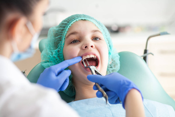 Egy lány a fogorvosnál. A szájüreg és a fogak vizsgálata gyermekeknél. - Fotó, kép