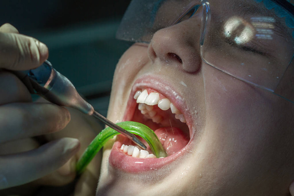 Une fille au rendez-vous chez le dentiste. Inspection de la cavité buccale et des dents chez un enfant
. - Photo, image