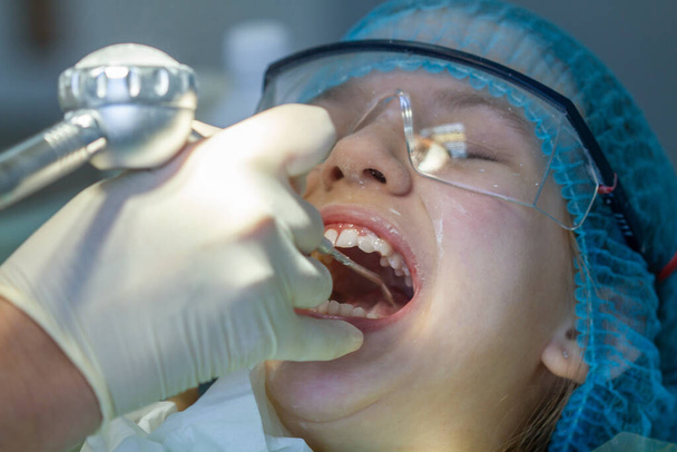 Dziewczyna z wizyty u dentysty. Kontrola jamy ustnej i zębów u dziecka. - Zdjęcie, obraz