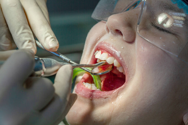 Tyttö hammaslääkärin vastaanotolla. Suuontelon ja hampaiden tarkastus lapsessa
. - Valokuva, kuva