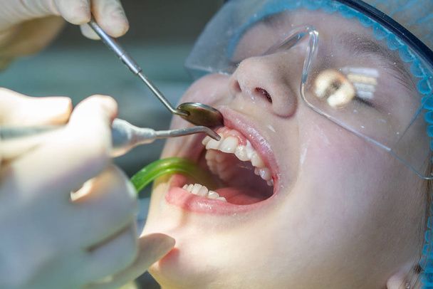 Dziewczyna z wizyty u dentysty. Kontrola jamy ustnej i zębów u dziecka. - Zdjęcie, obraz