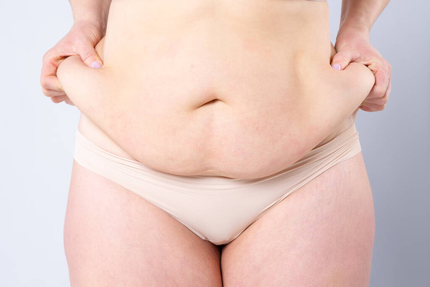 Tummy tuck, flabby skin on a fat belly, plastic surgery concept on gray background - Photo, image