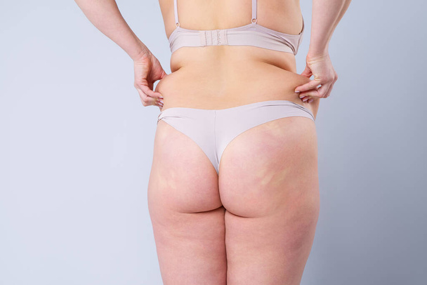 Overweight woman with fat hips and buttocks, obesity female body on gray background, studio shot - Zdjęcie, obraz