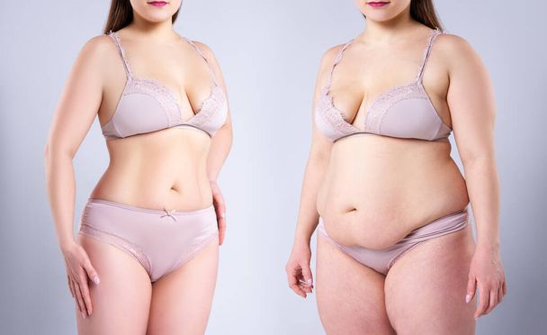 Woman's body before and after weight loss on gray background, plastic surgery concept - Photo, image