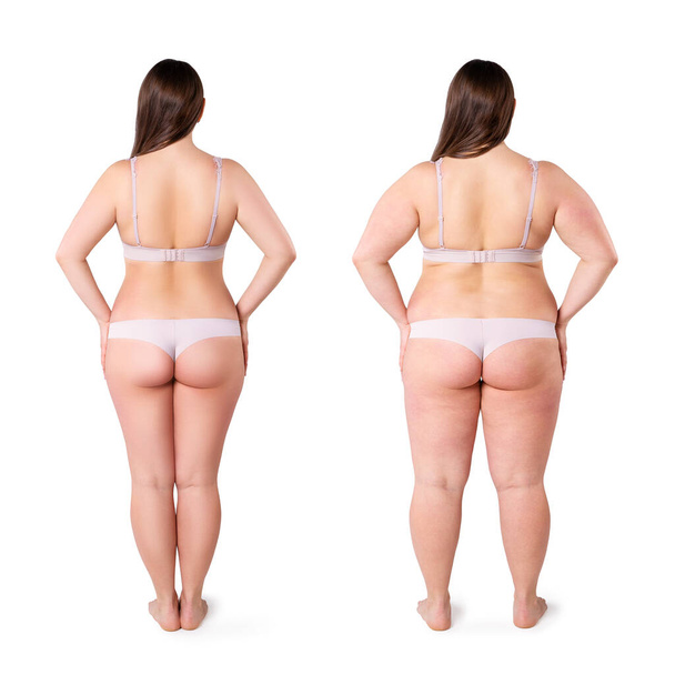 Woman's body before and after weight loss isolated on white background, plastic surgery concept - Fotografie, Obrázek