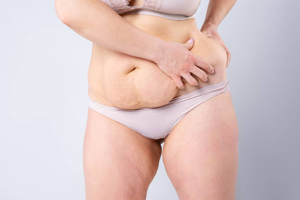 Tummy tuck, flabby skin on a fat belly, plastic surgery concept on gray background - Foto, Imagen