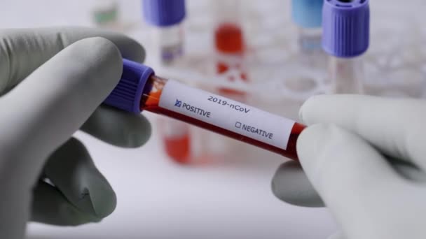 tubo de amostra de sangue com teste de coronavírus positivo
 - Filmagem, Vídeo