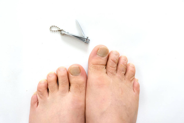 ένα άτομο που κόβει νύχια ποδιών, καθαρίζει νύχια, στο λευκό πάτωμα, ένα άτομο κόβει νύχια ποδιών του, - Φωτογραφία, εικόνα