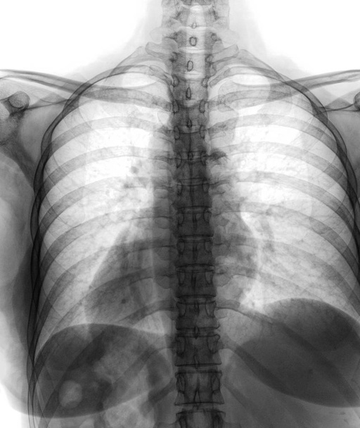 Spine and pelvis of a human body on x-ray. - Photo, Image