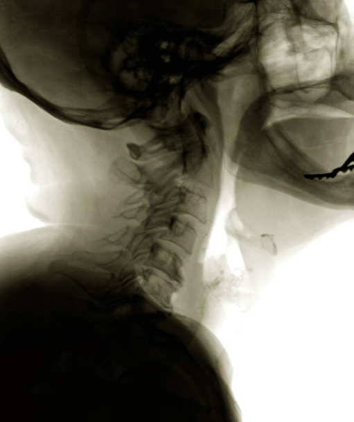 Diagnostická hlava X-ray film pacienta, boční pohled - Fotografie, Obrázek