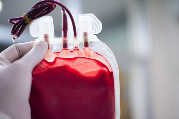 Fermez sac de sang rouge dans le laboratoire de la banque de sang
. - Photo, image